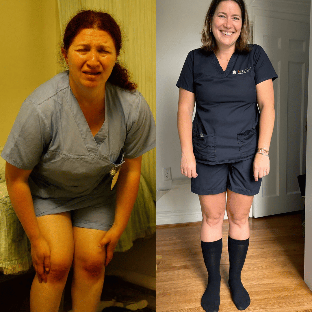 This Used To Be My Ankles After a 12-Hour Shift… Now I Walk Out Pain-Free.