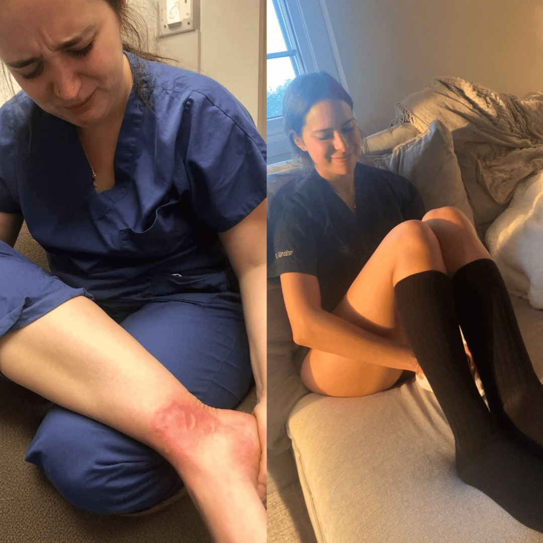 This Used To Be My Ankles After a 12-Hour Shift… Now I Walk Out Pain-Free.