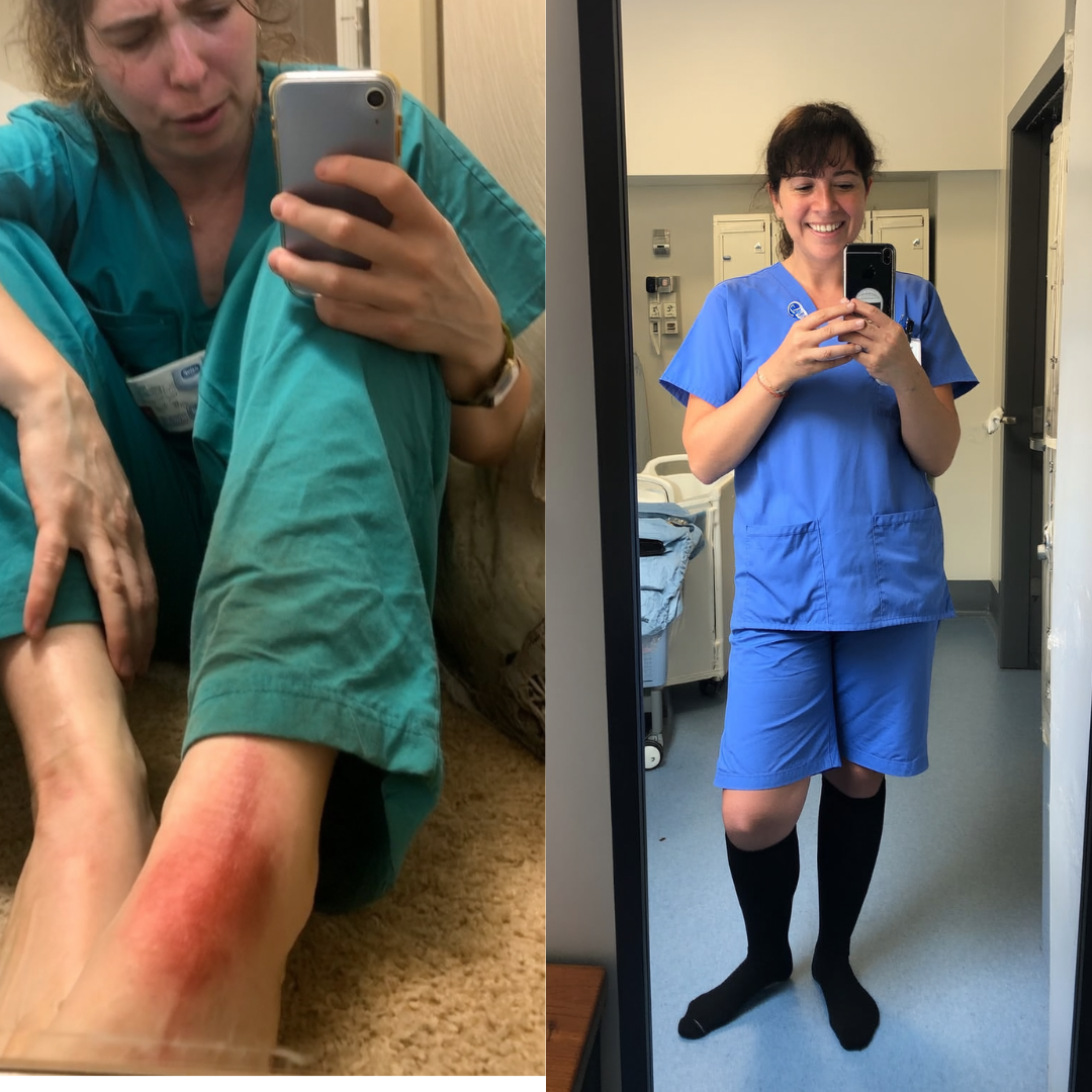 This Used To Be My Ankles After a 12-Hour Shift… Now I Walk Out Pain-Free.